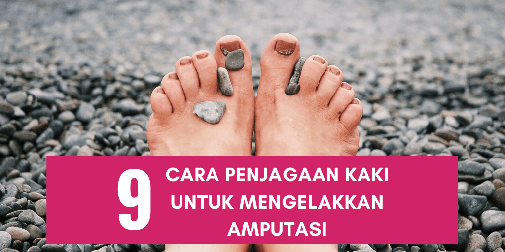 9 cara penjagaan kaki untuk mengelakkan amputasi