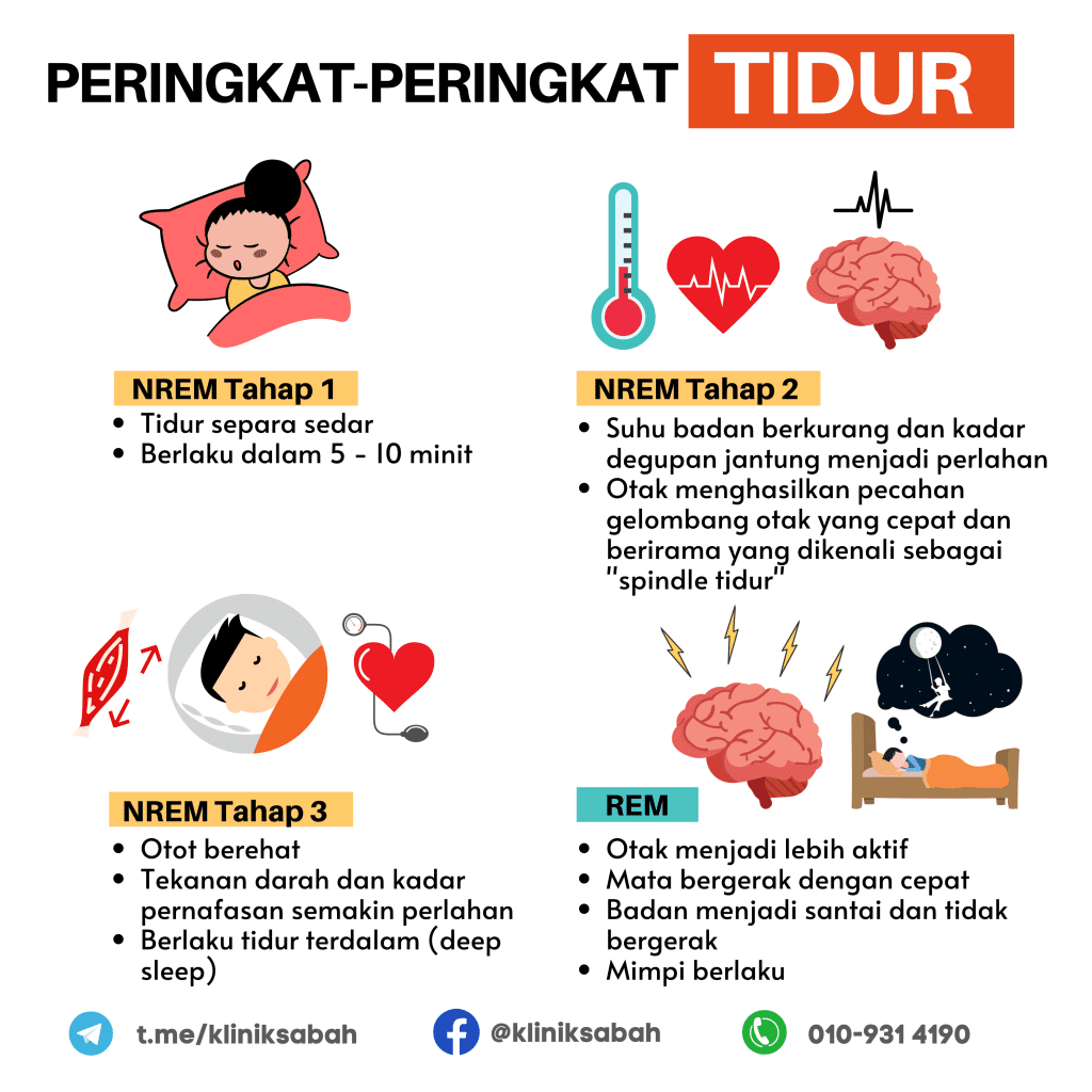Peringkat-peringkat tidur