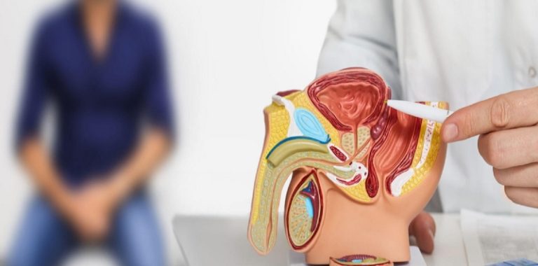 Punca Kemandulan Lelaki: Memahami Faktor-Faktor yang Mempengaruhi Kesuburan