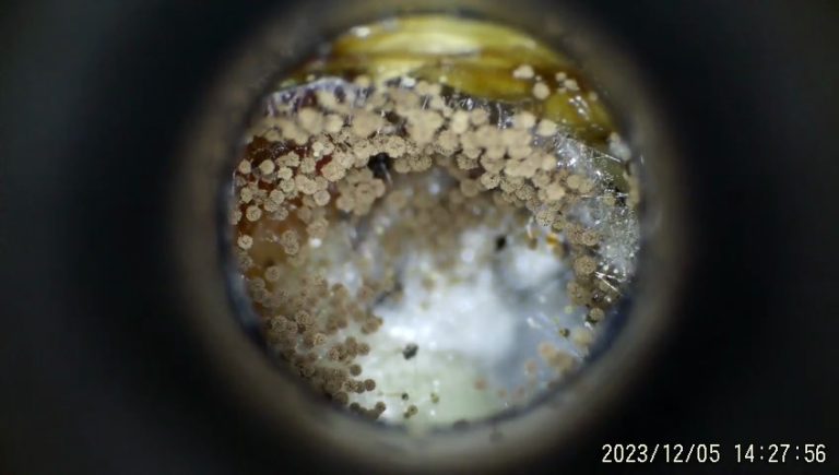 Telinga Gatal atau Sakit? Mungkin Jangkitan Kulat – Ketahui Apa Yang Perlu Anda Lakukan!