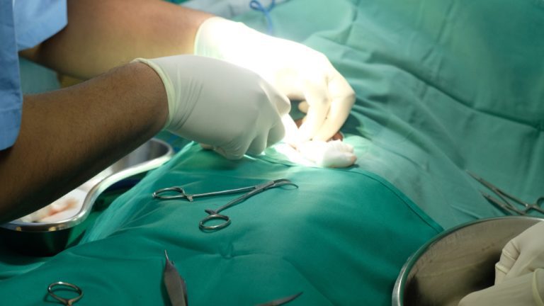 Kenapa Sunat Lebih Baik Dilakukan Semasa Kanak-Kanak Berbanding Dewasa?